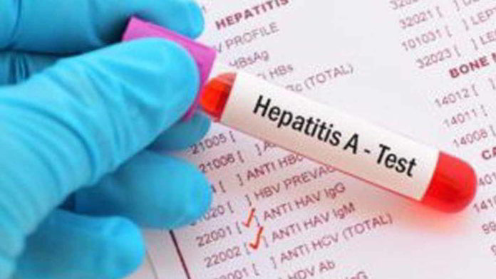 Hepatitis A