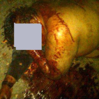 Kondisi salah seorang pelaku pencurian setelah dihajar ratusan massa, di Dusun Cilele, Desa Cimerak Kecamatan Cimerak, Kabupaten Pangandaran, Minggu (10/08/2014) sore. Foto: sumber HR