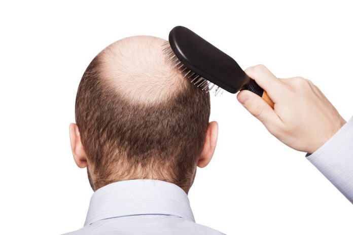 Makanan Penumbuh Rambut, Ini Daftarnya!