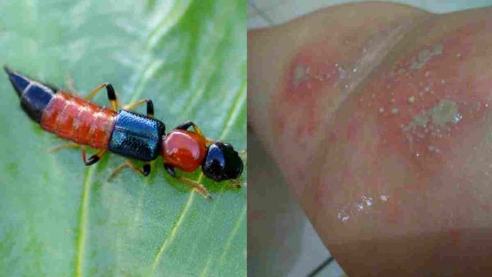 cara mengobati serangan tomcat