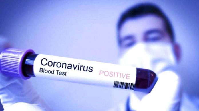 virus corona yang telah membuat geger masyarakat dunia