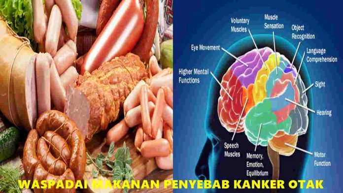 Makanan Penyebab Kanker Otak yang Perlu Anda Waspadai