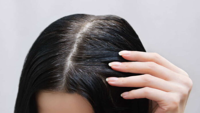 Makanan Penyebab Rambut Cepat Beruban yang Harus Dihindari!