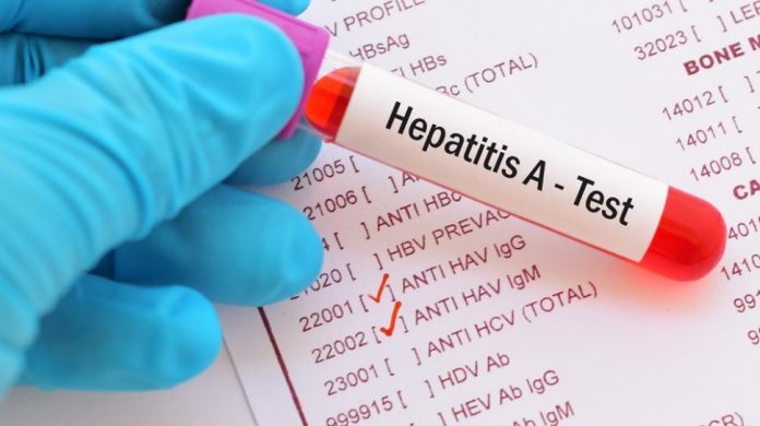 Mencegah Penularan Hepatitis A