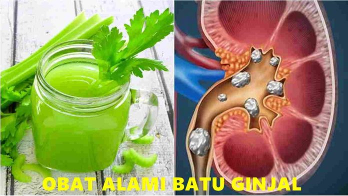 Obat Alami Batu Ginjal yang Mudah Kita Temukan - Harapan Rakyat