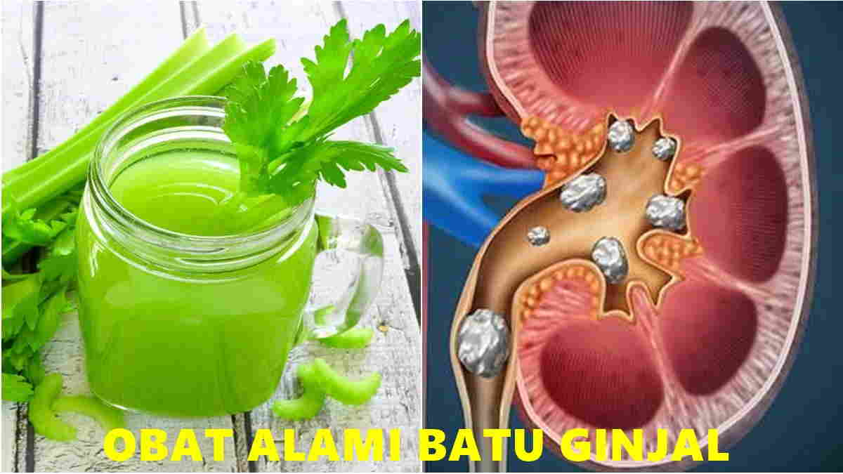 Obat Alami Batu Ginjal yang Mudah Kita Temukan Harapan Rakyat