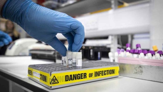 jenis tes virus corona di Indonesia
