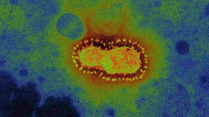 Wujud Asli Virus Corona