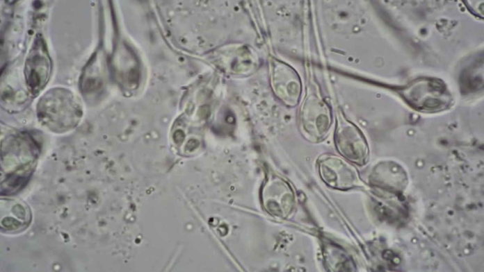 Fakta Henneguya Salminicola