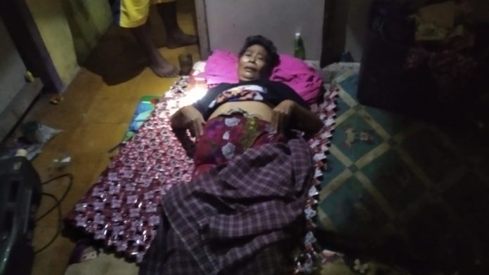 Pecah Usus