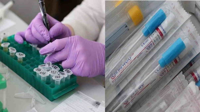 alat test Covid-19
