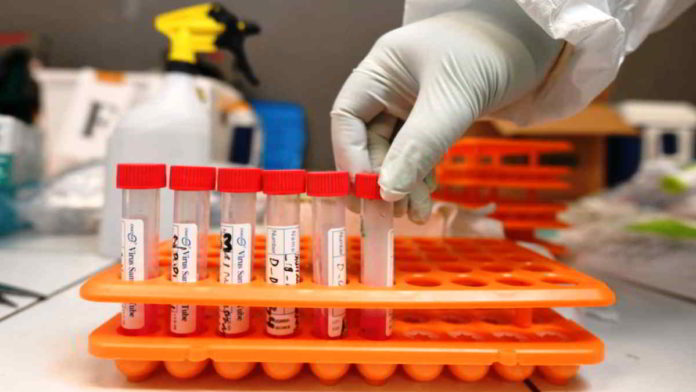 Uji 3.000 sampel swab test perhari dilakukan tim di Balai Laboratorium Kesehatan Provinsi Jawa Barat (Labkes Jabar). Foto: Humas Jabar.