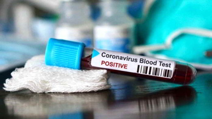 Tren peningkatan kasus positif Covid-19 di Jawa Barat sudah diprediksi oleh pakar epidemiologi. Foto: Ilustrasi/Net.
