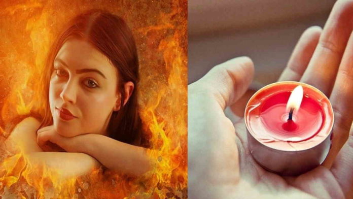 obat luka bakar alami