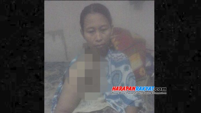 Menderita Kanker Payudara 2 Tahun, Warga Ciamis Ini Butuh Bantuan