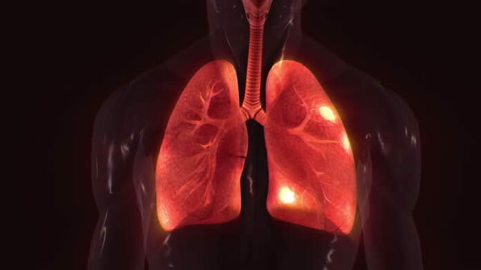 Sistem Pernapasan pada Manusia, Ini Nama Organ dan Fungsinya!