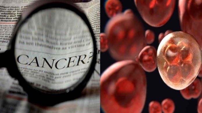 Penyebab Penyakit Leukemia, Gejala dan Cara Mencegahnyadan Cara Mengatasinya