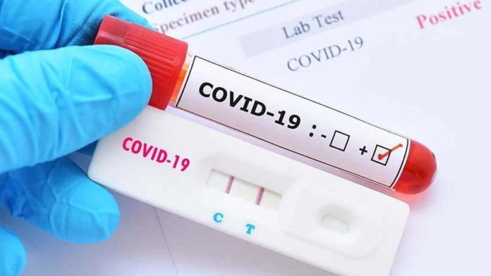 Seorang Sales Obat di Kota Banjar Positif Covid-19