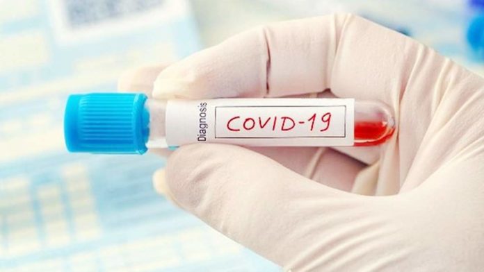 Kadinkes Pangandaran Terkonfirmasi Positif COVID-19