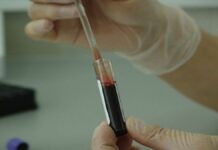 Karakteristik Plasma Darah