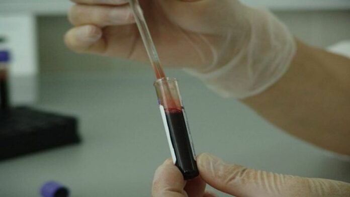 Karakteristik Plasma Darah