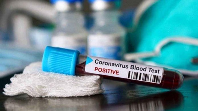 Kasus positif virus Corona di Kota Banjar, Jawa Barat, bertambah lagi dua orang. Foto: Ilustrasi/Net.