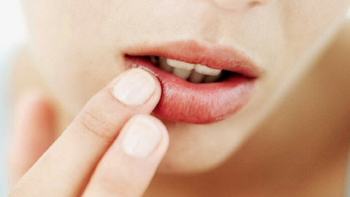 Penyebab Bibir Bengkak