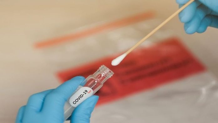 Swab Tes Pasien Covid-19