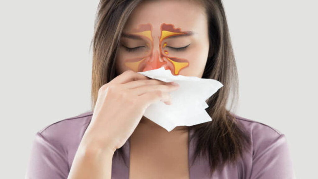 Manfaat Daun Sirih untuk Sinusitis