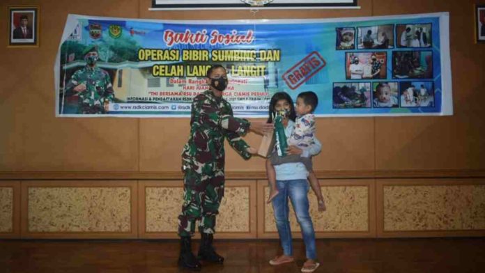 Operasi Bibir Sumbing Ciamis