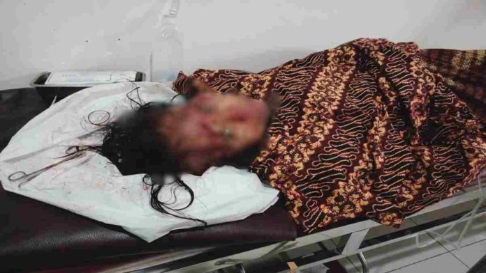 pria di pangandaran bacok