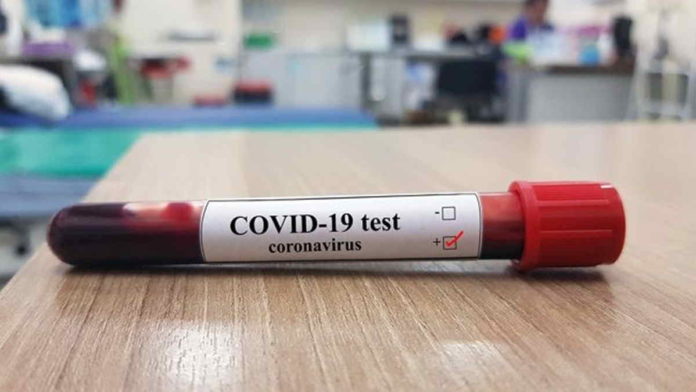 Makin Tak Terkendali, Warga Banjar Positif Covid-19 Bertambah 18 Orang