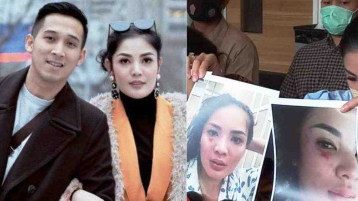 Nindy Ayunda dan Suami Cerai Akibat KDRT dan Selingkuh