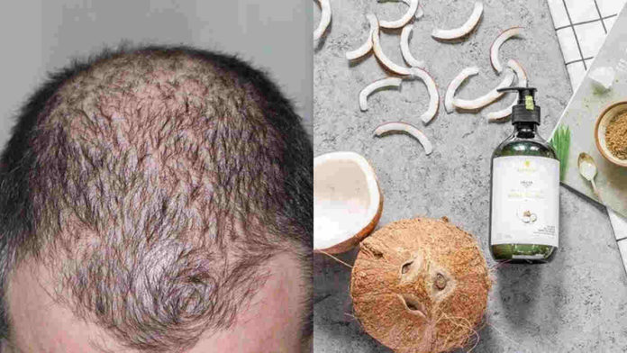 rambut lebat dan tebal