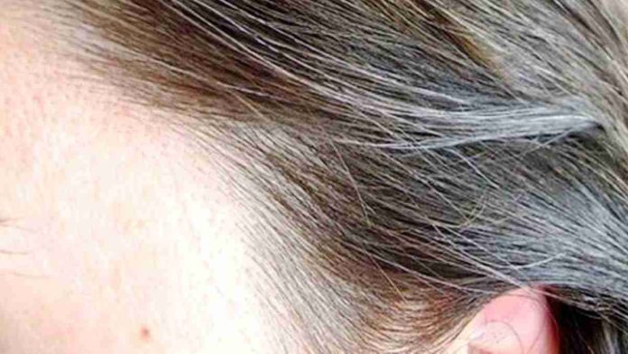 Rambut Beruban