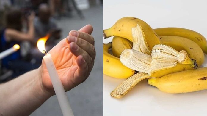 menghilangkan bekas luka bakar