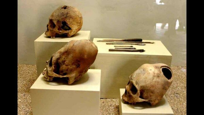 Fosil Aneh di Peru, Rongga Mata di Tengkorak Memanjang