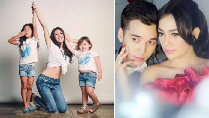 Putri Celine Evangelista Patah Tulang