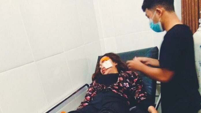 Gadis Cantik di Pangandaran Jadi Korban Jambret, Alami Kerugian Jutaan