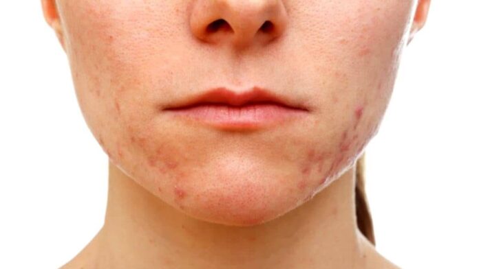 Rekomendasi Skincare