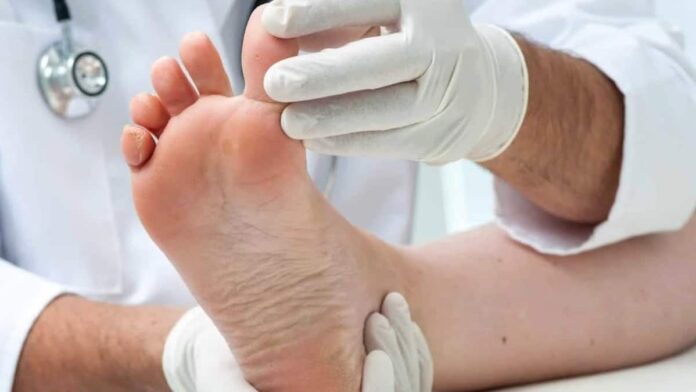 Masalah Kesehatan yang Serius Bisa Dilihat dari Kondisi Kaki