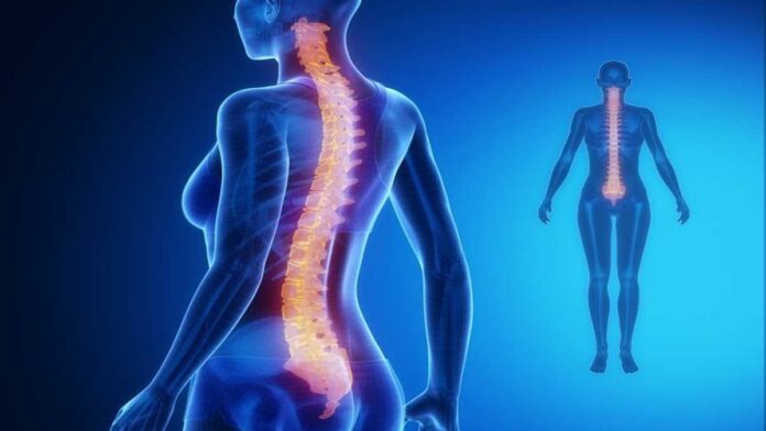 Kelainan Tulang Lordosis: Faktor Penyebab, Jenis dan Cara Mencegahnya