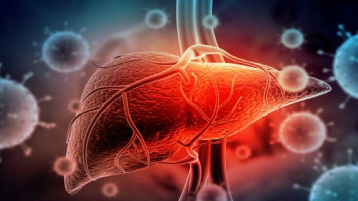 Penyebab Penyakit Hepatitis yang Wajib Anda Ketahui