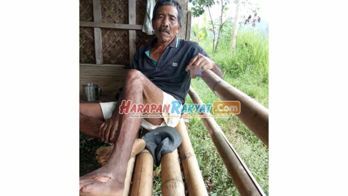 Usai Digigit Ular 5 Bulan Lalu, Kaki Pria di Ciamis Jadi Melepuh Seperti Ini