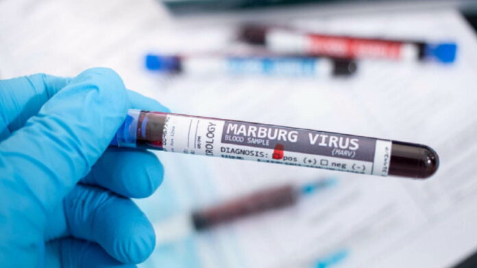 Cara Penularan Virus Marburg Cukup Mudah, Berisiko Kematian!