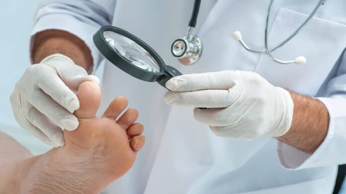 Aplikasi Cegah Amputasi Diabetes Si Paud Akhirnya Resmi Hadir