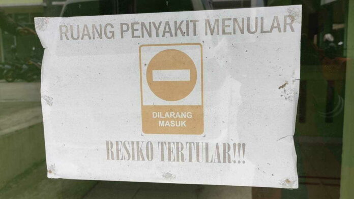 cacar monyet