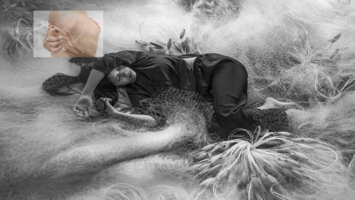 Arti Mimpi Borok di Badan