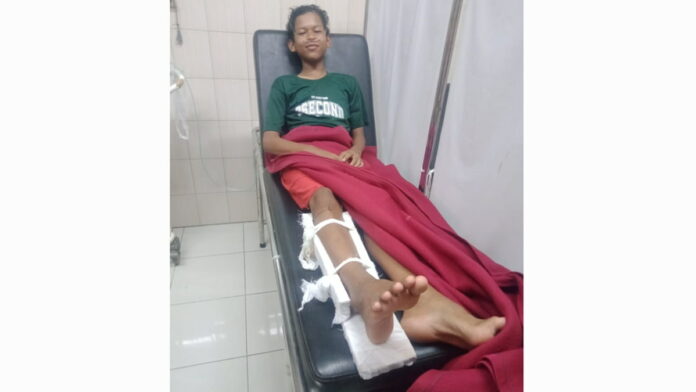 Remaja Injak Ular Kobra di Ciamis