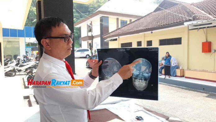 Kepala Korban Penganiayaan di Kota Banjar
